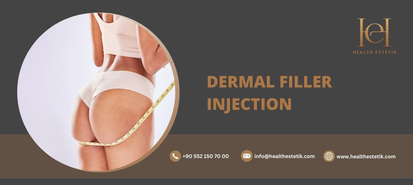 Инъекция наполнителя